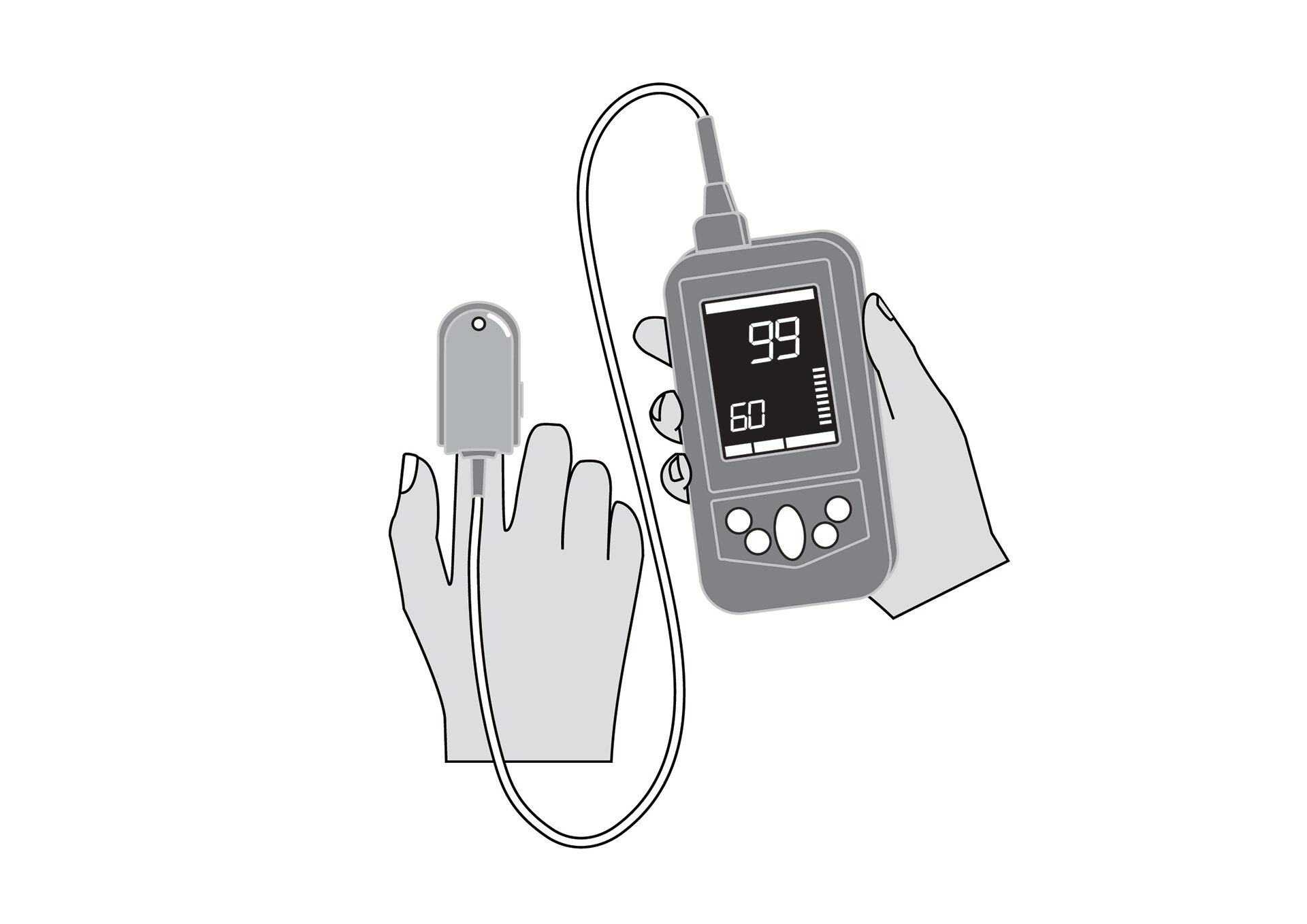 pulse oximeter Pulse Oximeter - Image 1